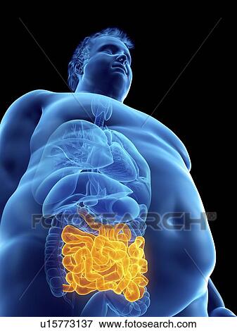 Stock Photo - Illustration of an obese man's intestine. Fotosearch