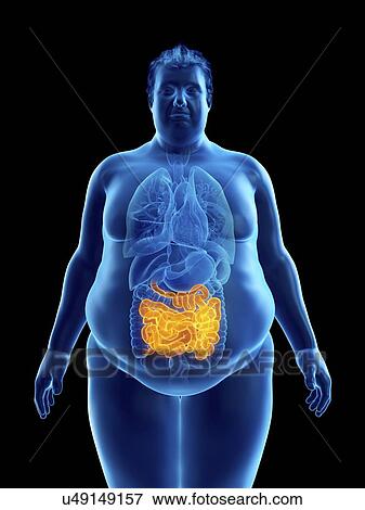 Illustration of an obese man's intestine View Large Photo Image Stock Photo - Illustration of an obese man's intestine. Fotosearch