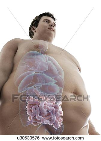Stock Photograph - Illustration of an obese man's intestine. Fotosearch