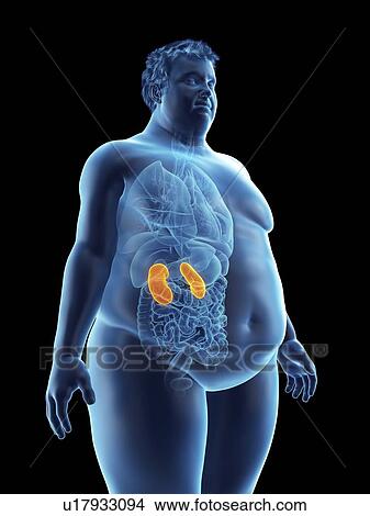 Picture - Illustration of an obese man's kidneys. Fotosearch