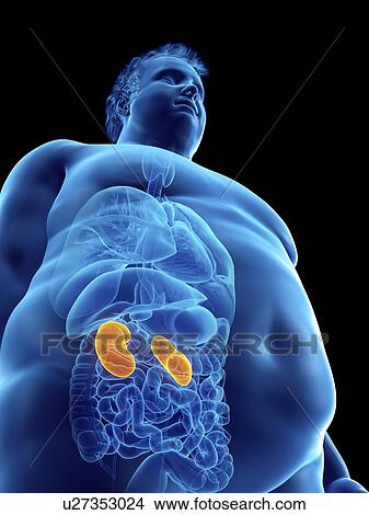 Picture - Illustration of an obese man's kidneys. Fotosearch