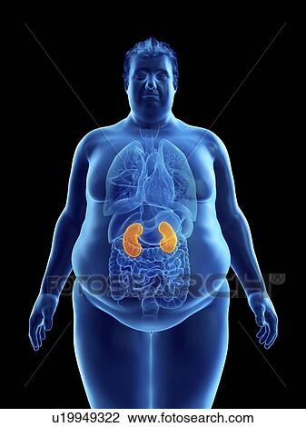 Stock Image - Illustration of an obese man's kidneys. Fotosearch