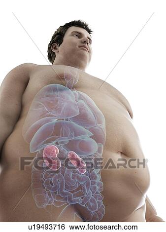Stock Photograph - Illustration of an obese man's kidneys. Fotosearch