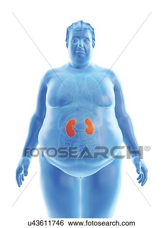Stock Photograph - Illustration of an obese man's kidneys. Fotosearch