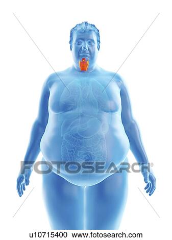 Stock Image - Illustration of an obese man's larynx. Fotosearch