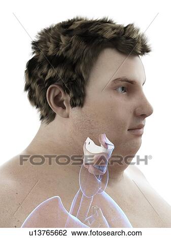 Stock Image - Illustration of an obese man's larynx. Fotosearch