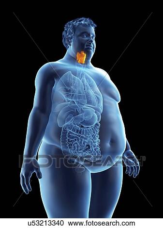 Stock Image - Illustration of an obese man's larynx. Fotosearch