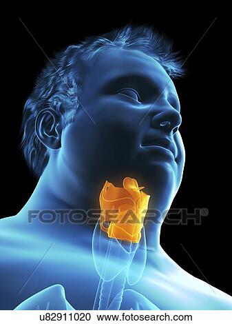 Illustration of an obese man's larynx View Large Photo Image Stock Image - Illustration of an obese man's larynx. Fotosearch