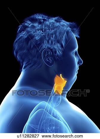 Stock Photo - Illustration of an obese man's larynx. Fotosearch
