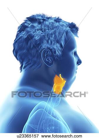 Stock Photo - Illustration of an obese man's larynx. Fotosearch