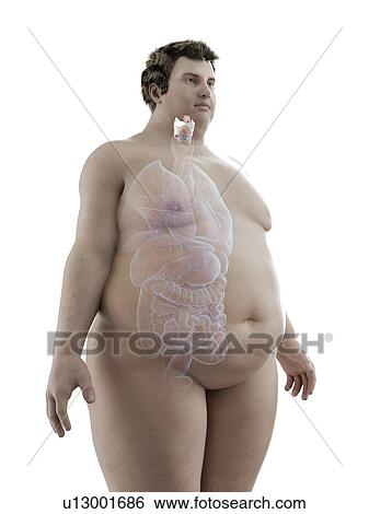 Stock Photograph - Illustration of an obese man's larynx. Fotosearch