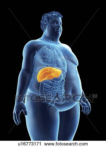 Illustration of an obese man's liver View Large Photo Image Stock Image - Illustration of an obese man's liver. Fotosearch