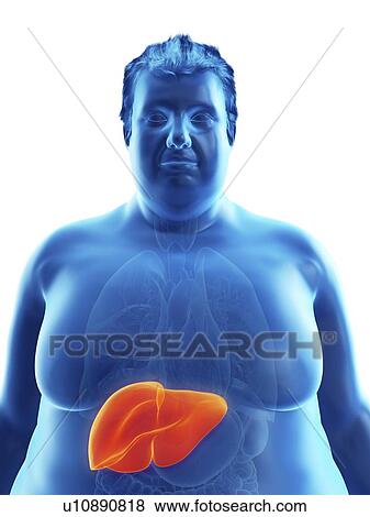 Stock Photo - Illustration of an obese man's liver. Fotosearch
