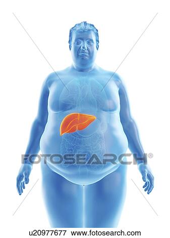 Stock Photo - Illustration of an obese man's liver. Fotosearch