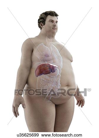 Illustration of an obese man's liver View Large Photo Image Stock Photo - Illustration of an obese man's liver. Fotosearch