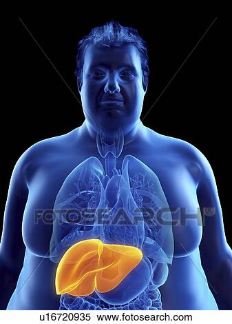 Stock Photography - Illustration of an obese man's liver. Fotosearch