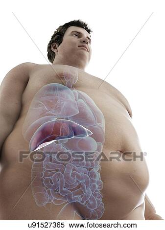 Stock Photography - Illustration of an obese man's liver. Fotosearch