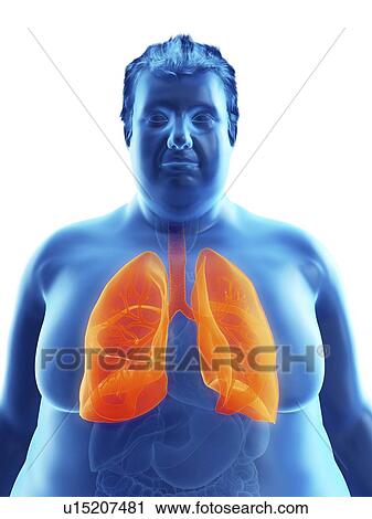 Stock Image - Illustration of an obese man's lungs. Fotosearch