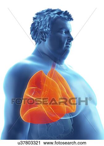 Illustration of an obese man's lungs View Large Photo Image Stock Image - Illustration of an obese man's lungs. Fotosearch