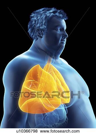 Illustration of an obese man's lungs View Large Photo Image Stock Photo - Illustration of an obese man's lungs. Fotosearch
