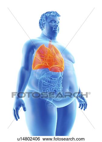 Illustration of an obese man's lungs View Large Photo Image Stock Photograph - Illustration of an obese man's lungs. Fotosearch