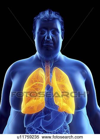 Stock Photography - Illustration of an obese man's lungs. Fotosearch