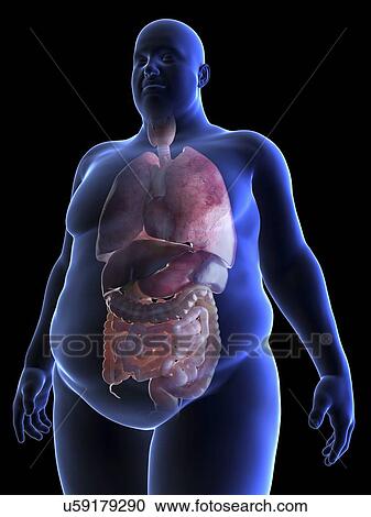 Illustration of an obese man's organs View Large Photo Image Stock Image - Illustration of an obese man's organs. Fotosearch