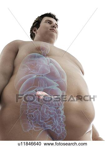 Stock Image - Illustration of an obese man's pancreas. Fotosearch