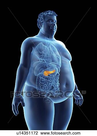 Illustration of an obese man's pancreas View Large Photo Image Stock Image - Illustration of an obese man's pancreas. Fotosearch