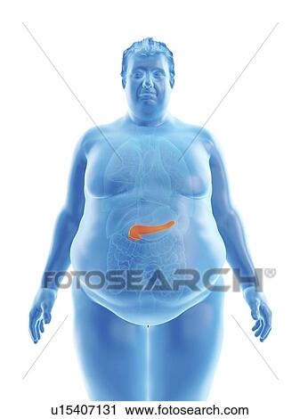 Stock Image - Illustration of an obese man's pancreas. Fotosearch