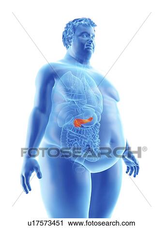 Illustration of an obese man's pancreas View Large Photo Image Stock Image - Illustration of an obese man's pancreas. Fotosearch
