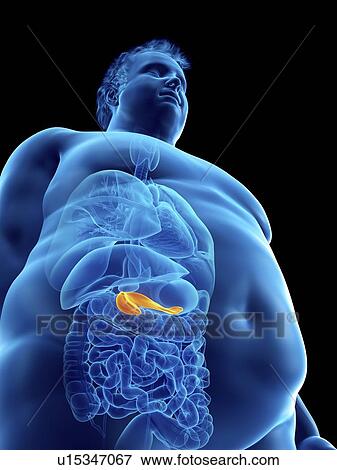 Illustration of an obese man's pancreas View Large Photo Image Stock Photo - Illustration of an obese man's pancreas. Fotosearch