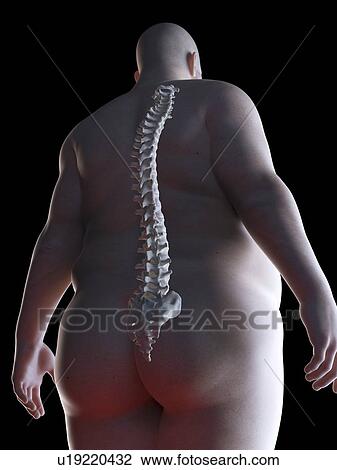 Illustration of an obese man's spine View Large Photo Image Stock Image - Illustration of an obese man's spine. Fotosearch