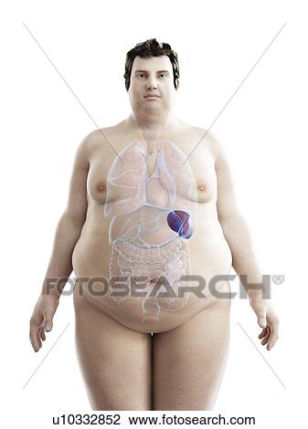 Illustration of an obese man's spleen View Large Photo Image Stock Image - Illustration of an obese man's spleen. Fotosearch