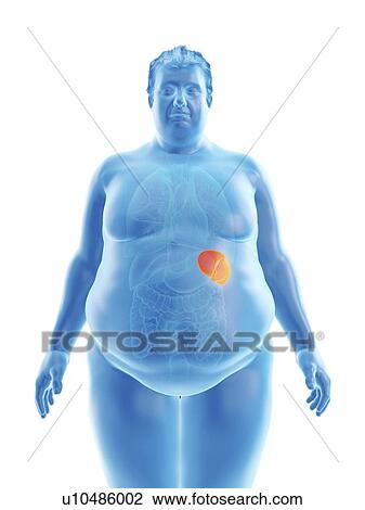Stock Image - Illustration of an obese man's spleen. Fotosearch