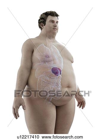 Stock Image - Illustration of an obese man's spleen. Fotosearch