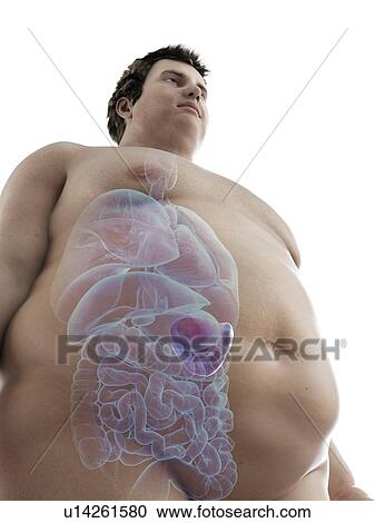 Illustration of an obese man's spleen View Large Photo Image Stock Image - Illustration of an obese man's spleen. Fotosearch