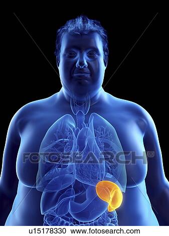 Stock Image - Illustration of an obese man's spleen. Fotosearch