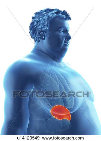 Illustration of an obese man's spleen View Large Photo Image Stock Photo - Illustration of an obese man's spleen. Fotosearch