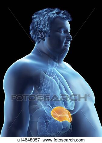 Illustration of an obese man's spleen View Large Photo Image Stock Photo - Illustration of an obese man's spleen. Fotosearch