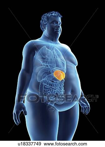 Illustration of an obese man's spleen View Large Photo Image Stock Photo - Illustration of an obese man's spleen. Fotosearch