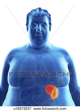 Stock Photo - Illustration of an obese man's spleen. Fotosearch