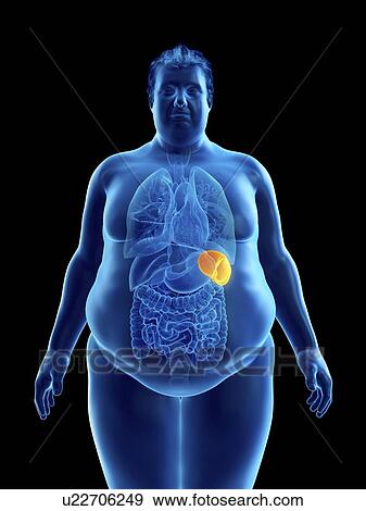 Illustration of an obese man's spleen View Large Photo Image Stock Photo - Illustration of an obese man's spleen. Fotosearch