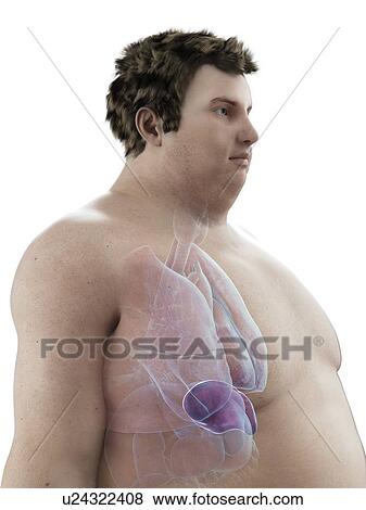 Stock Photo - Illustration of an obese man's spleen. Fotosearch