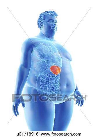Stock Photograph - Illustration of an obese man's spleen. Fotosearch