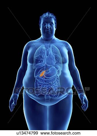 Illustration of an obese man's gallbladder View Large Photo Image Stock Photo - Illustration of an obese man's gallbladder. Fotosearch
