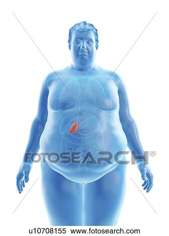 Stock Photography - Illustration of an obese man's gallbladder. Fotosearch