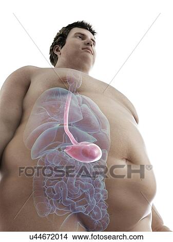 Picture - Illustration of an obese man's stomach. Fotosearch