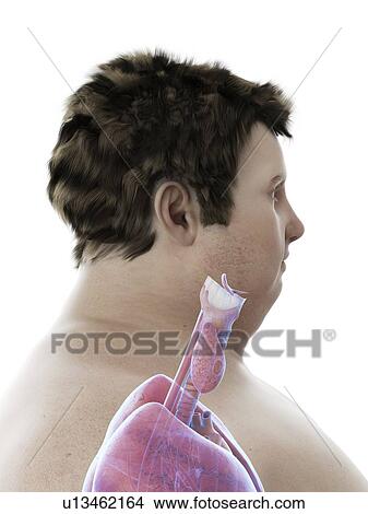 Picture - Illustration of an obese man's throat anatomy. Fotosearch