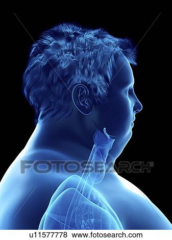 Stock Photo - Illustration of an obese man's throat anatomy. Fotosearch